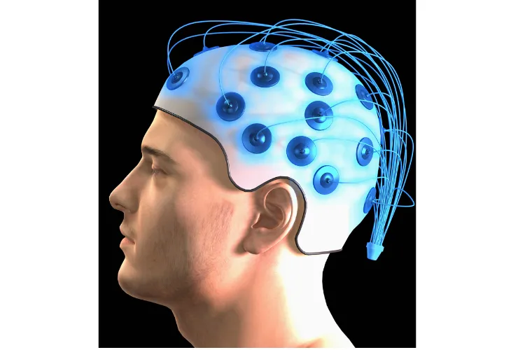 What is an Electroencephalogram (EEG) Test