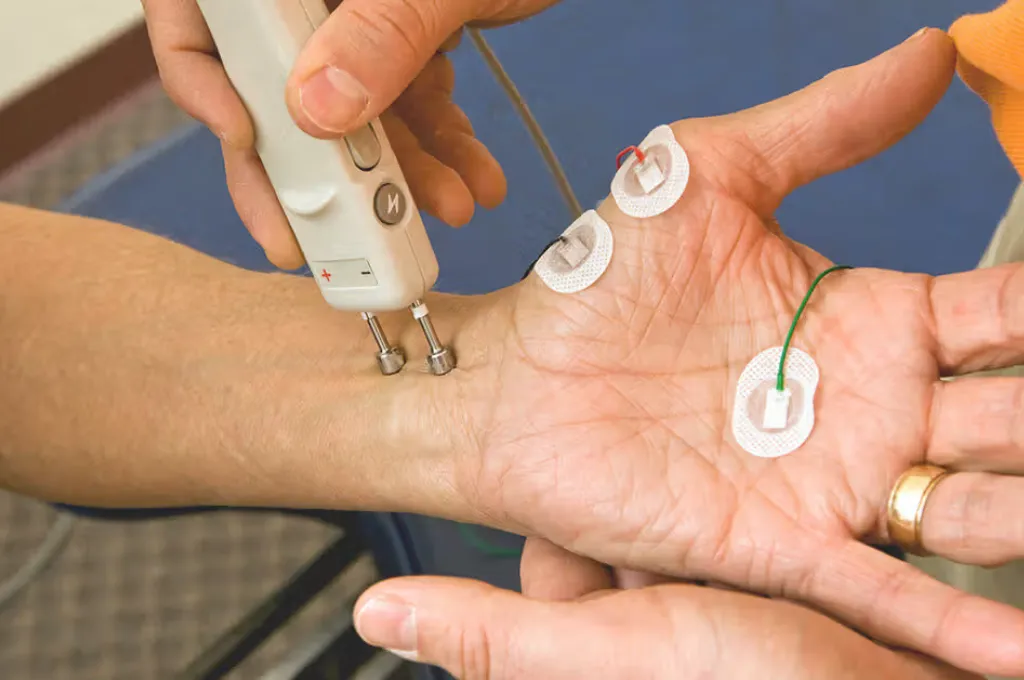 What is an Electromyography (EMG) Test