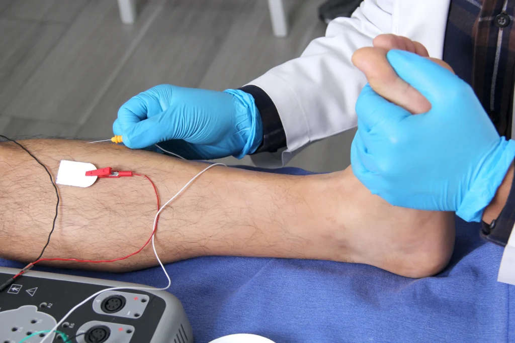 Why Choose Precision NeuroDiagnostics for EMG Tests in Houston